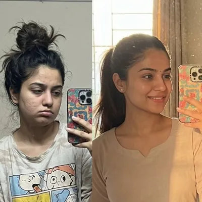— Ankita R., Delhi